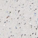 Carbonic Anhydrase XIV Antibody in Immunohistochemistry (Paraffin) (IHC (P))