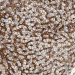 Carbonic Anhydrase XIV Antibody in Immunohistochemistry (Paraffin) (IHC (P))
