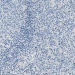 Carbonic Anhydrase XIV Antibody in Immunohistochemistry (Paraffin) (IHC (P))