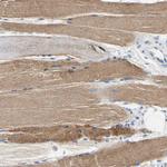 Carbonic Anhydrase XIV Antibody in Immunohistochemistry (Paraffin) (IHC (P))