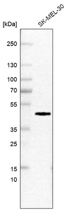 Carbonic Anhydrase XIV Antibody in Western Blot (WB)