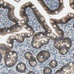 ITGA3 Polyclonal Antibody