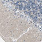 CACNA2D1 Antibody in Immunohistochemistry (Paraffin) (IHC (P))