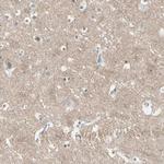 CACNA2D1 Antibody in Immunohistochemistry (Paraffin) (IHC (P))