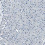 CACNA2D1 Antibody in Immunohistochemistry (Paraffin) (IHC (P))
