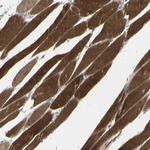 CACNA2D1 Antibody in Immunohistochemistry (Paraffin) (IHC (P))