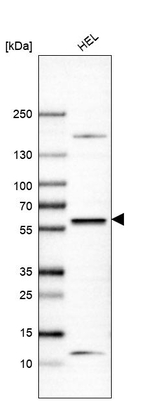 SUFU Antibody in Western Blot (WB)