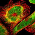 RING1 Polyclonal Antibody