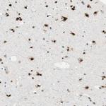 RING1 Antibody in Immunohistochemistry (Paraffin) (IHC (P))