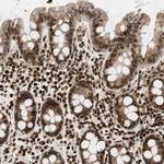 RING1 Antibody in Immunohistochemistry (Paraffin) (IHC (P))