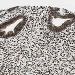 RING1 Antibody in Immunohistochemistry (Paraffin) (IHC (P))