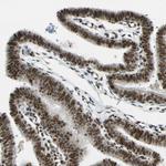 DAXX Antibody in Immunohistochemistry (Paraffin) (IHC (P))