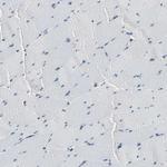 DAXX Antibody in Immunohistochemistry (Paraffin) (IHC (P))