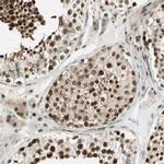 DAXX Polyclonal Antibody