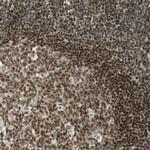 DAXX Antibody in Immunohistochemistry (Paraffin) (IHC (P))