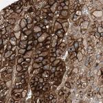 ALPL Antibody in Immunohistochemistry (Paraffin) (IHC (P))