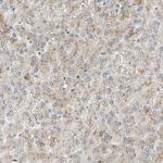 ALPL Antibody in Immunohistochemistry (Paraffin) (IHC (P))