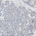 ALPL Antibody in Immunohistochemistry (Paraffin) (IHC (P))
