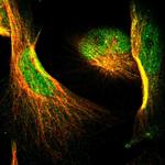 NFATC2 Polyclonal Antibody