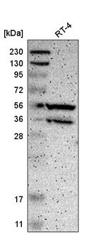 PPP3CB Antibody in Western Blot (WB)