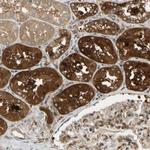 PARP14 Antibody in Immunohistochemistry (Paraffin) (IHC (P))