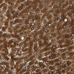 PARP14 Antibody in Immunohistochemistry (Paraffin) (IHC (P))
