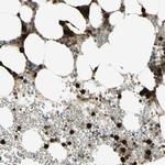 Cyclin B2 Antibody in Immunohistochemistry (Paraffin) (IHC (P))
