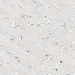 Cyclin B2 Antibody in Immunohistochemistry (Paraffin) (IHC (P))