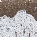 FLII Antibody in Immunohistochemistry (Paraffin) (IHC (P))