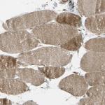 FLII Antibody in Immunohistochemistry (Paraffin) (IHC (P))