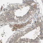 FLII Antibody in Immunohistochemistry (Paraffin) (IHC (P))