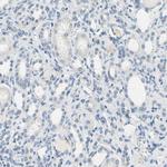 CD23 Antibody in Immunohistochemistry (Paraffin) (IHC (P))