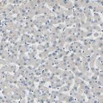 CD23 Antibody in Immunohistochemistry (Paraffin) (IHC (P))