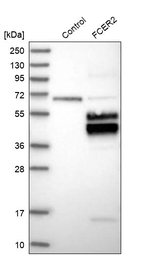 CD23 Antibody in Western Blot (WB)