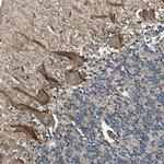 NUAK2 Antibody in Immunohistochemistry (Paraffin) (IHC (P))