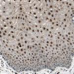 NUAK2 Antibody in Immunohistochemistry (Paraffin) (IHC (P))