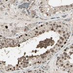 NUAK2 Antibody in Immunohistochemistry (Paraffin) (IHC (P))