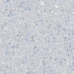 GYPC Antibody in Immunohistochemistry (Paraffin) (IHC (P))