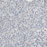 GYPC Polyclonal Antibody