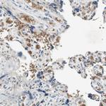 GYPC Antibody in Immunohistochemistry (Paraffin) (IHC (P))
