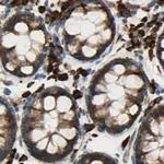 RRBP1 Antibody in Immunohistochemistry (Paraffin) (IHC (P))