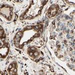 RRBP1 Antibody in Immunohistochemistry (Paraffin) (IHC (P))