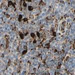 RRBP1 Antibody in Immunohistochemistry (Paraffin) (IHC (P))