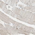 RRBP1 Antibody in Immunohistochemistry (Paraffin) (IHC (P))