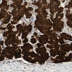 RRBP1 Antibody in Immunohistochemistry (Paraffin) (IHC (P))