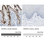 CDHR5 Antibody