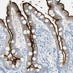 CDHR5 Antibody in Immunohistochemistry (Paraffin) (IHC (P))
