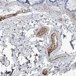 PDGF-C Antibody in Immunohistochemistry (Paraffin) (IHC (P))