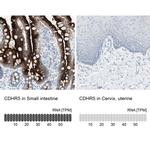 CDHR5 Antibody
