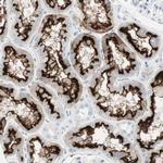 CDHR5 Antibody in Immunohistochemistry (Paraffin) (IHC (P))